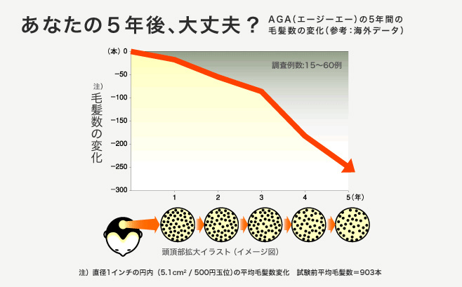 海外のAGA5年間の毛髪数の変化データ