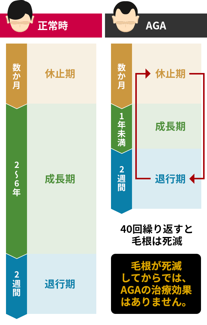 正常時とAGAのサイクル