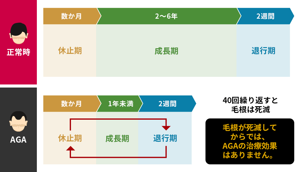 正常時とAGAのサイクル