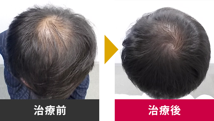 治療前・治療後